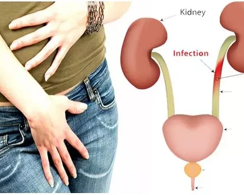 बारम्बार पिसाब लाग्नु: शरीरको संकेत हो या गहिरो समस्या? एक विस्तृत विश्लेषण