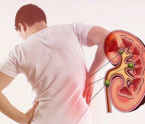के तपाईलाई पनि पेट दुख्ने समस्या छ ? होशियार हुनुहोस है